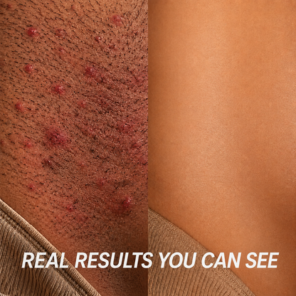 Lusensix™ Anti-Hair Growth Oil